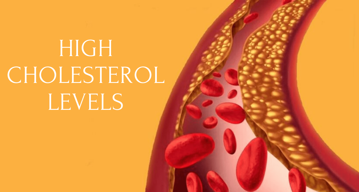 Manage High Cholesterol Levels