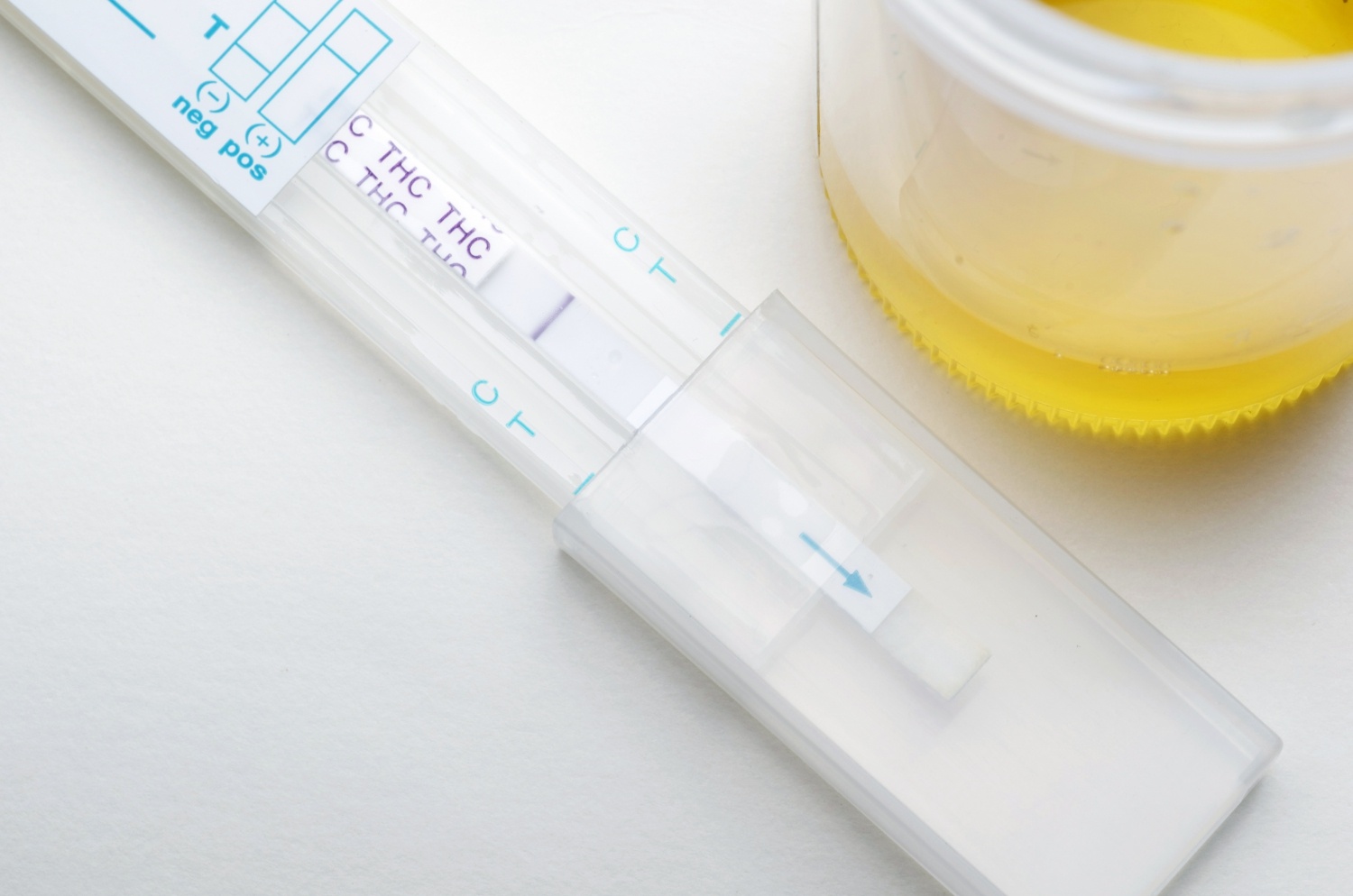 Urine Drug Test in workplace